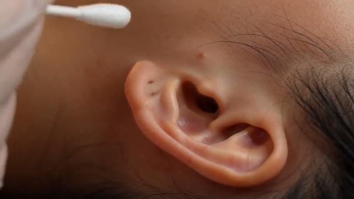 耳道清洁 ASMR 视频模板 模板预览